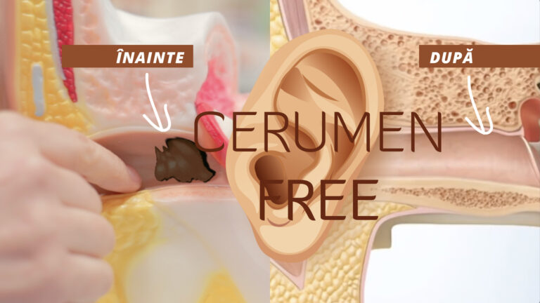 Imagine comparativă înainte și după folosirea soluției Cerumen Free pentru eliminarea dopurilor de ceară din urechi, cu rezultate vizibile