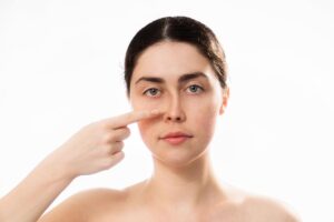 Femeie care indică zona nasului unde deviația de sept poate necesita intervenție chirurgicală pentru a corecta obstrucția nazală și dificultățile de respirație