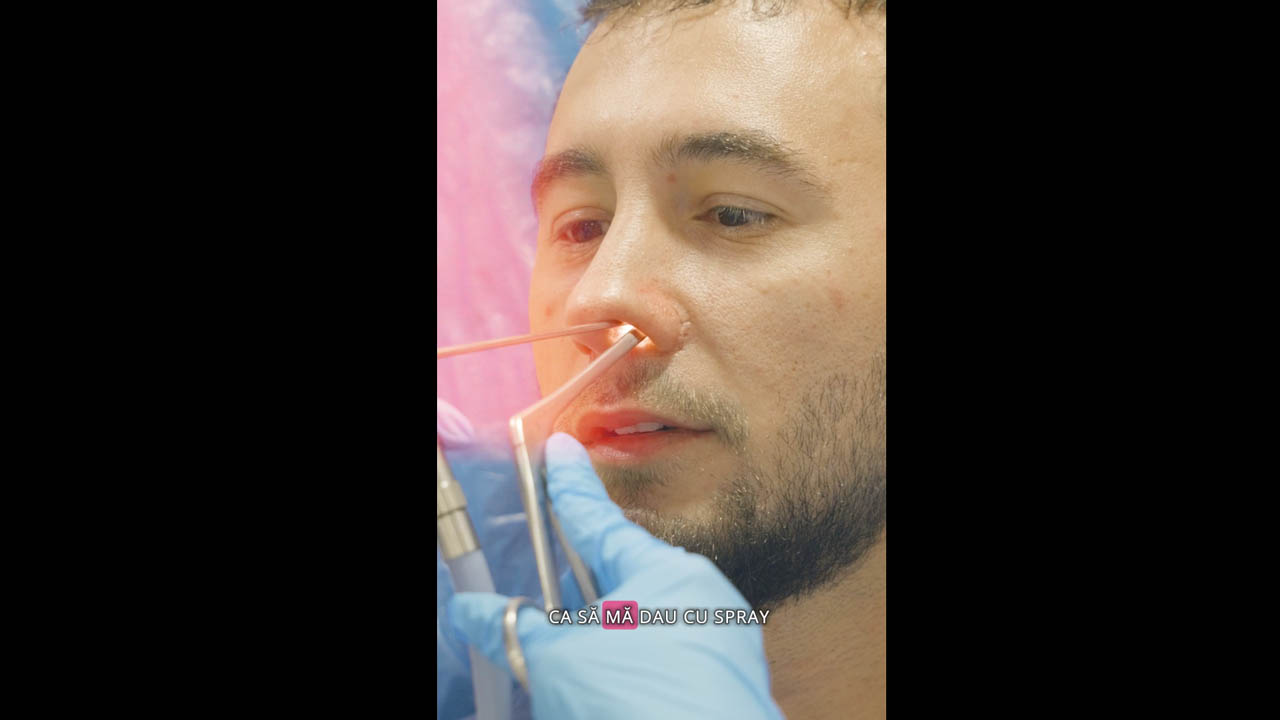 DEPENDENȚĂ PICĂTURI 2 ANI, DUPĂ TR, CONTROL